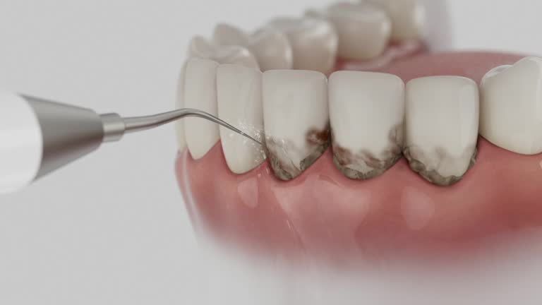 Trusted Tooth Extraction service in Stanton, TX - Dentist Open Now
